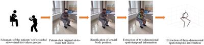 Exploring the potential of the sit-to-stand test for self-assessment of <mark class="highlighted">physical condition</mark> in advanced knee osteoarthritis patients using computer vision